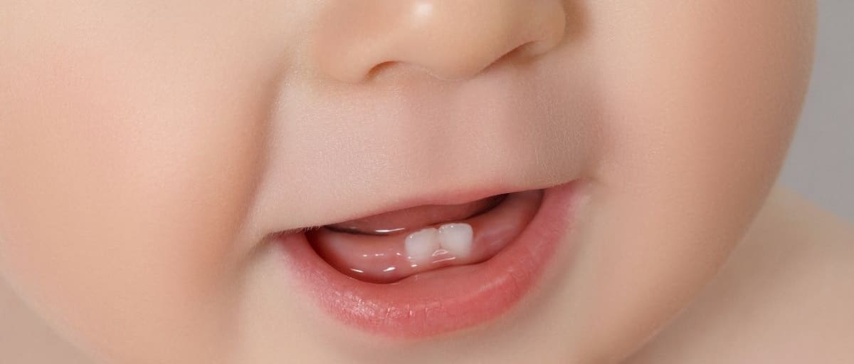 Aliviar los síntomas de la erupción dental